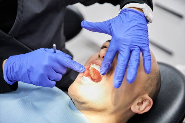 Best Emergency Broken Tooth Repair in Doolittle, TX